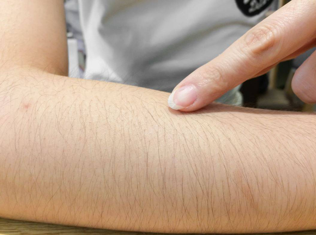 Ağda, ip ve cımbızı unutun! Bir kaşıkla tüyleri yok edin - Resim: 27